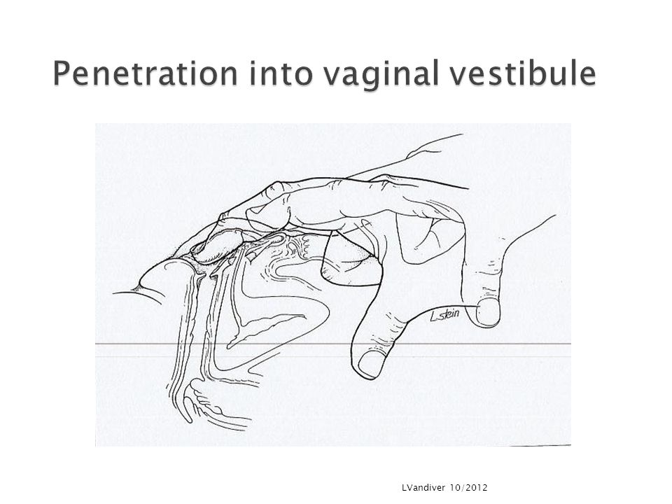 Object penetrated vagina