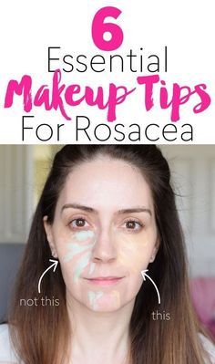 Makeup for dry mature rosacea