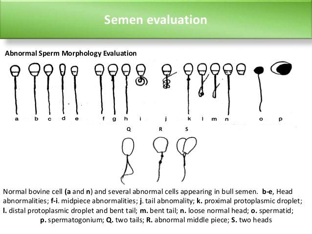 Goldfish reccomend Morphology sperm cells
