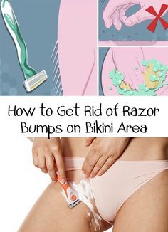 best of Bikini line bumps Home remedy