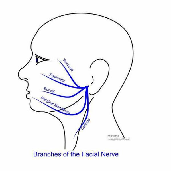 Branch facial nerve
