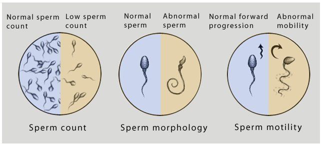 Count infertility low sperm