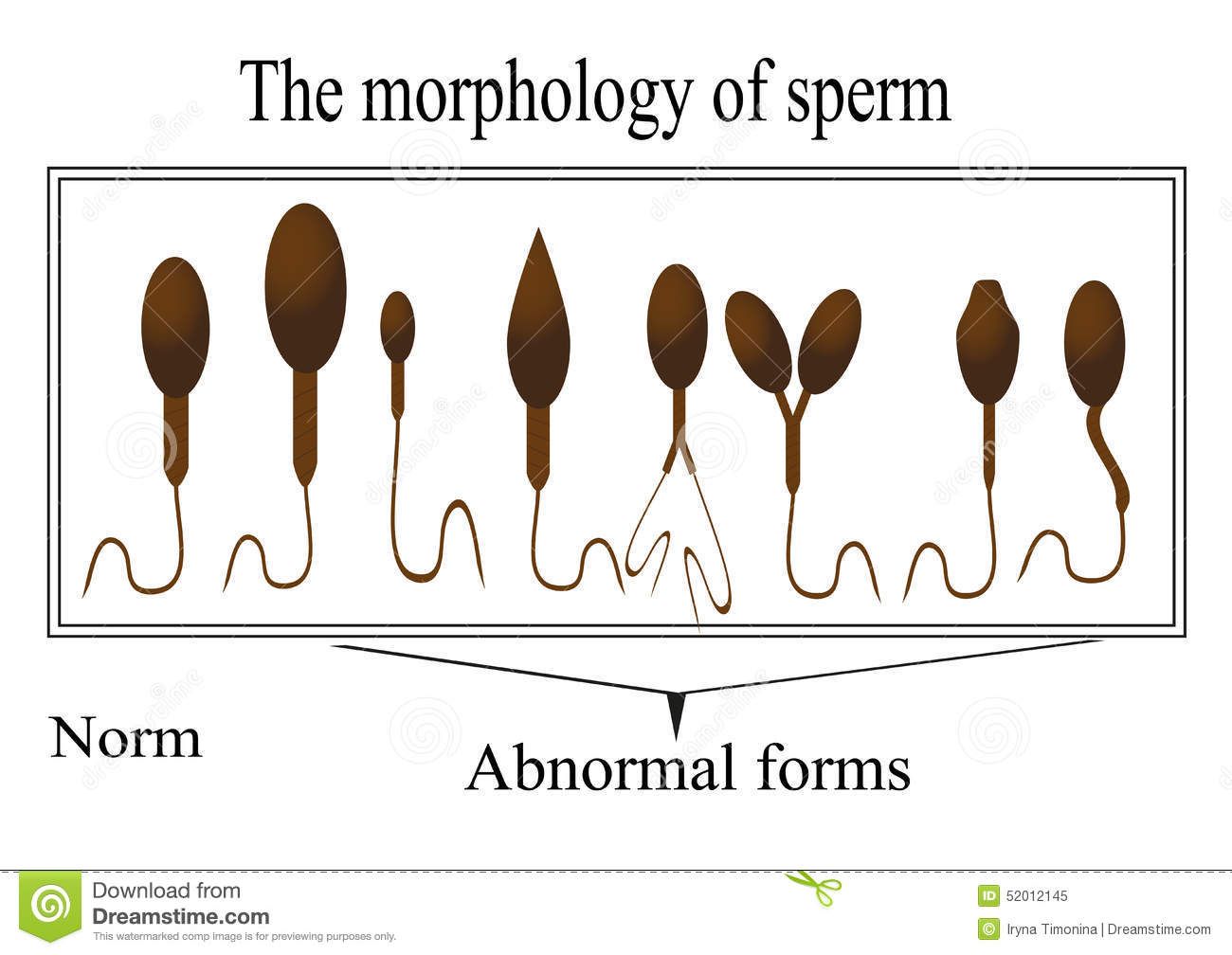 best of Sperm cells Morphology