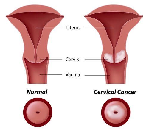 best of Sex Cervix penetration during