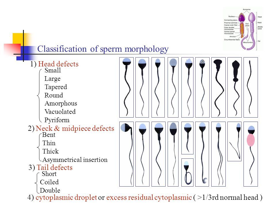 Fuzz reccomend Morphology sperm cells