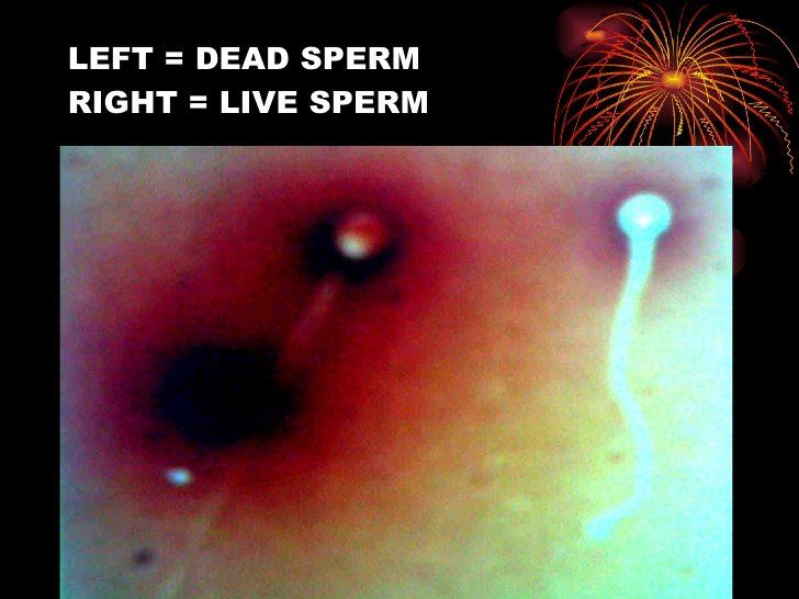 Is sperm dead when dry