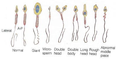 Morphology sperm cells