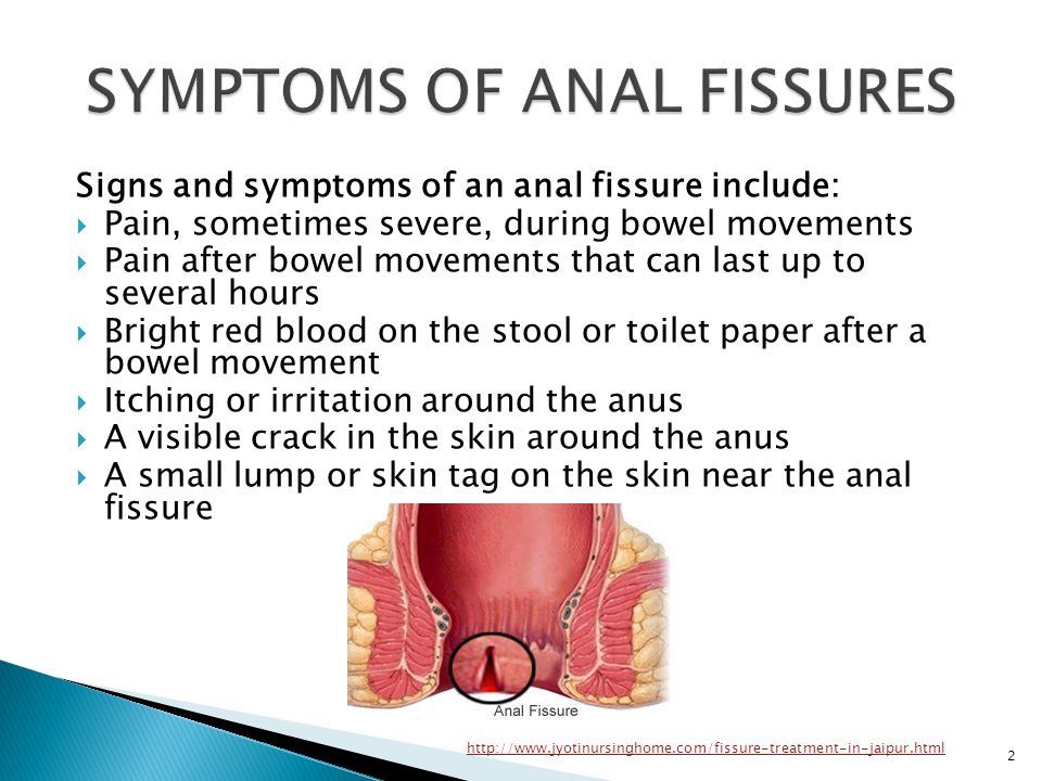 Side Z. reccomend Anal fissures and thin stools