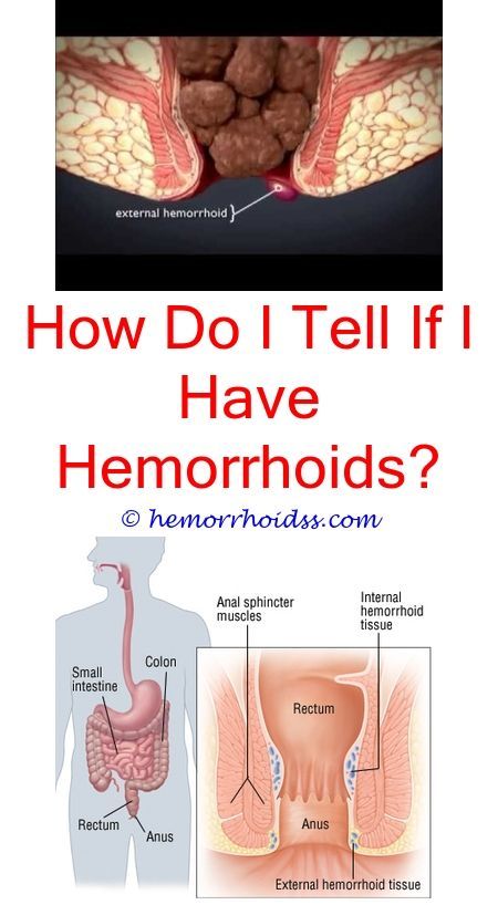 best of Hemorrhoids Masturbation helps