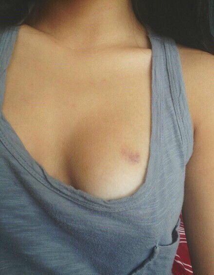 Boob Hickey Pictures Excellent Porn Comments 2