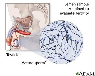 Sperm banks in ocala florida