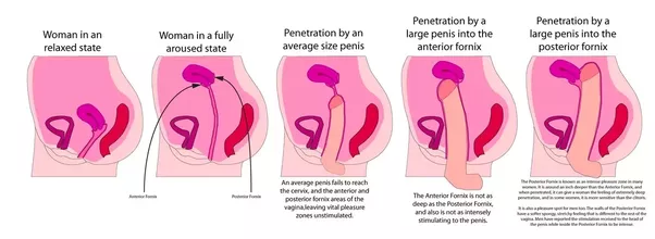 Penis penetrate my uterus