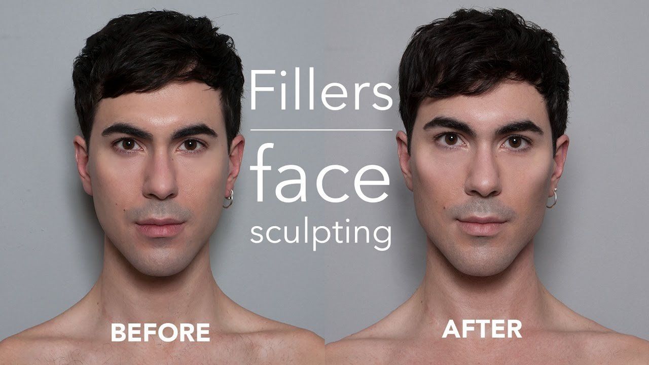 Twister reccomend Facial sculpting surgery