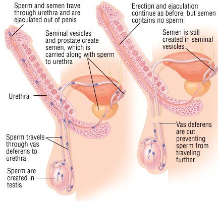 Penis and sperm and semen