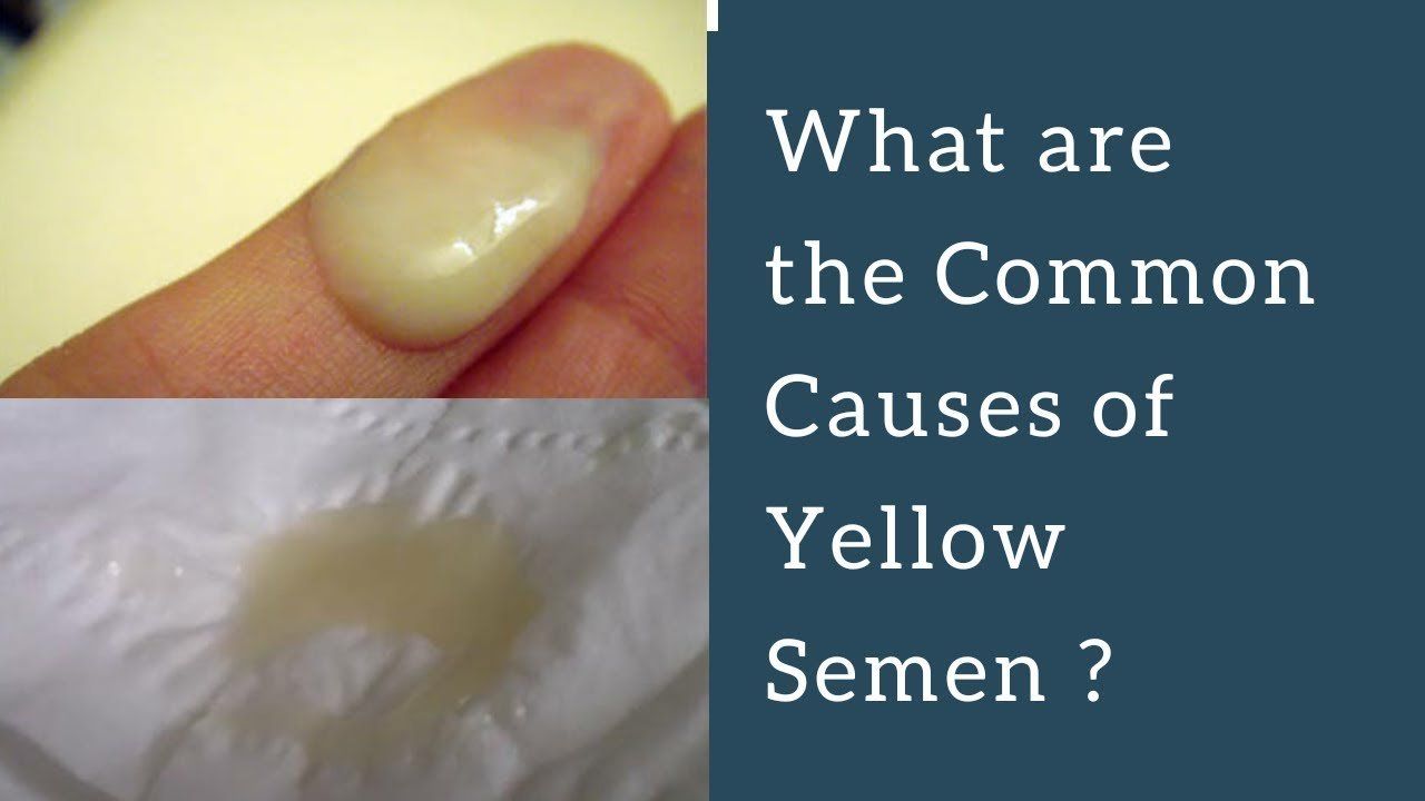 Yellow semen sperm