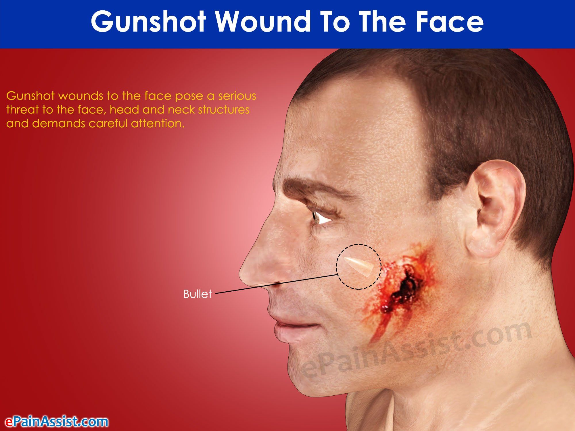 best of Nerve Facial wound damage healing