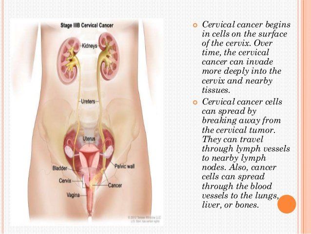 best of Cervix Penetrate cer