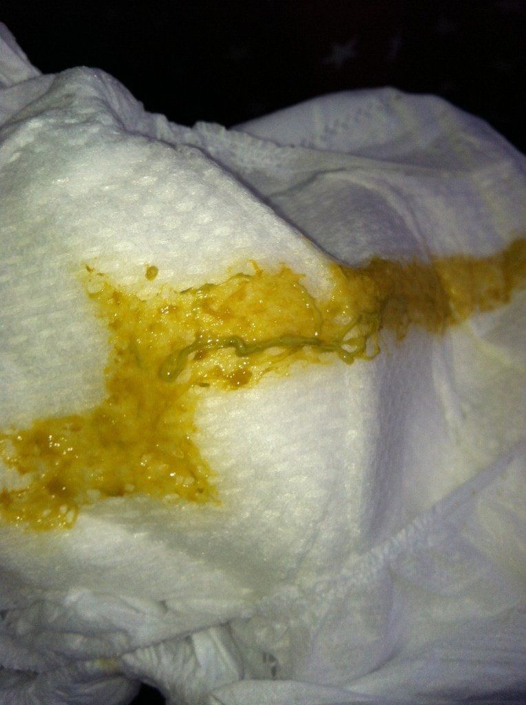 Anal mucus yellow