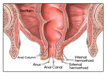 Anus model rectum