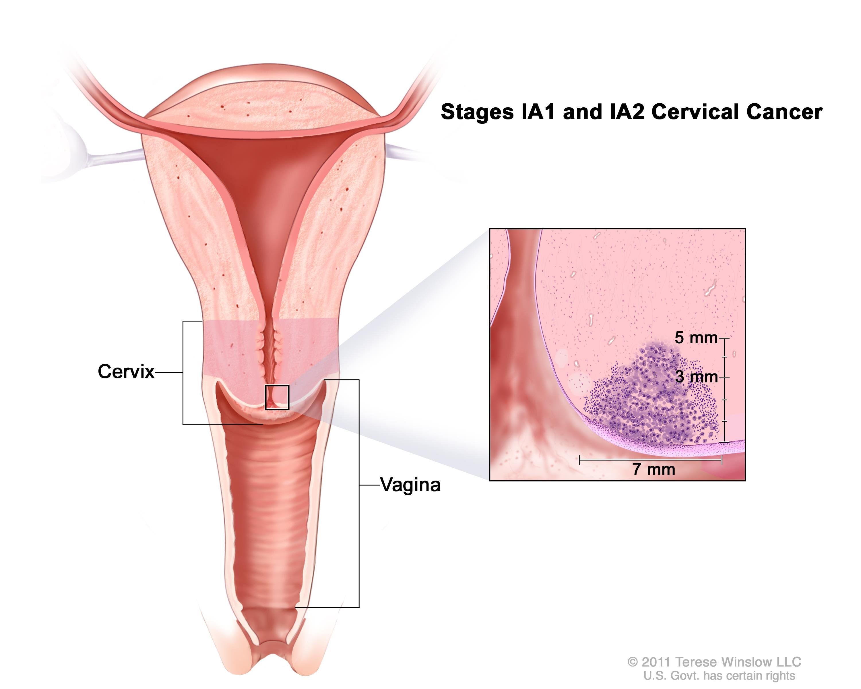 Cervical penetration pics