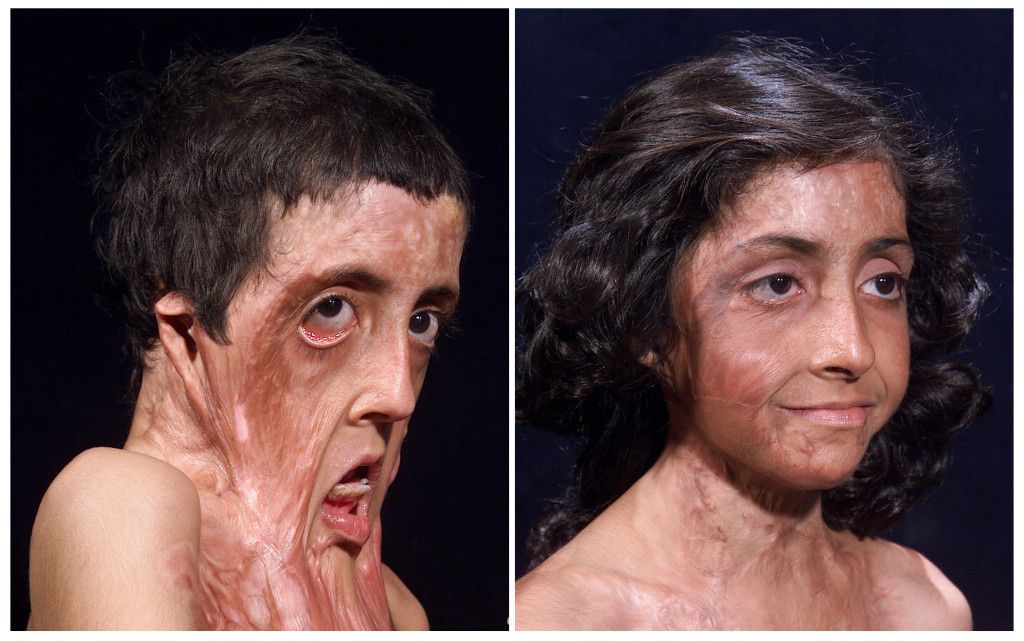 Facial reconstruction surgeons tennessee
