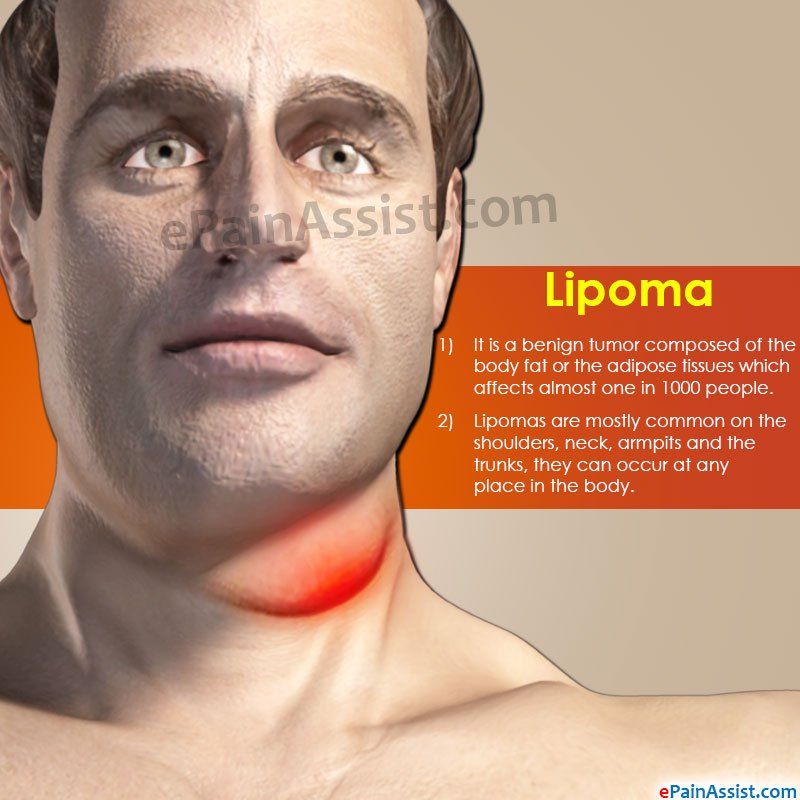 Facial blood accumulates lumps