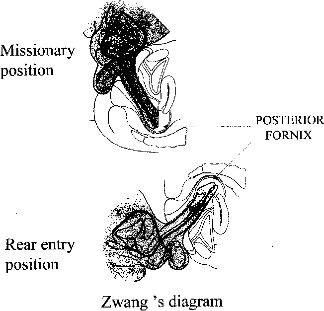 Missionary position diagram